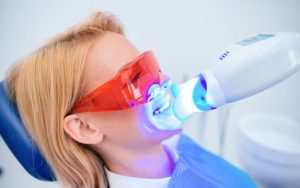 Tooth Whitening Treatments